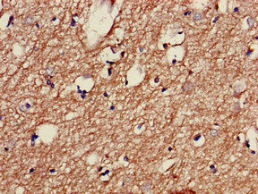 Immunohistochemistry of paraffin-embedded human brain tissue using TH Antibody at dilution of 1:100Rabbit anti-Human TH Polyclonal Antibody