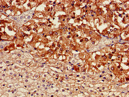 Immunohistochemistry of paraffin-embedded human adrenal gland tissue using TH Antibody at dilution of 1:100Rabbit anti-Human TH Polyclonal Antibody