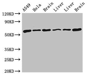 Western Blot | Positive WB detected in: A549 whole cell lysate, Hela whole cell lysate, Rat brain tissue, Rat liver tissue, Mouse liver tissue, Mouse brain tissue | All lanes: TH antibody at 4μg/ml | Secondary | Goat polyclonal to rabbit IgG at 1/50000 dilution | Predicted band size: 59, 56, 57, 46, 45 kDa | Observed band size: 59 kDaRabbit anti-Human TH Polyclonal Antibody
