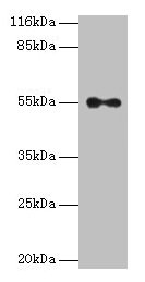 Western blot  | All lanes: THRA antibody at 2µg/ml + A431 whole cell lysate  | Secondary  | Goat polyclonal to rabbit IgG at 1/10000 dilution  | Predicted band size: 55, 47, 51 kDa  | Observed band size: 55 kDaRabbit anti-Human THRA Polyclonal Antibody