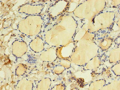 Immunohistochemistry of paraffin-embedded human thyroid tissue using THRB Antibody at dilution of 1:100Rabbit anti-Human THRB Polyclonal Antibody