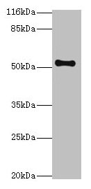 Western blot  | All lanes: THRB antibody at 2µg/ml + Mouse liver tissue  | Secondary  | Goat polyclonal to rabbit IgG at 1/10000 dilution  | Predicted band size: 53, 55 kDa  | Observed band size: 53 kDaRabbit anti-Human THRB Polyclonal Antibody