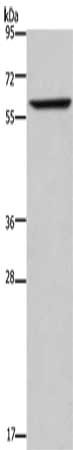 Gel: 8%SDS-PAGE, Lysate: 40 μg, Lane: Mouse liver tissue, Primary antibody: ENTPD5 Antibody(ENTPD5 Antibody) at dilution 1/200, Secondary antibody: Goat anti rabbit IgG at 1/8000 dilution, Exposure time: 3 minutesRabbit anti-Human ENTPD5 Polyclonal Antibody