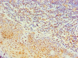 Immunohistochemistry of paraffin-embedded human tonsil tissue using TIA1 Antibody at dilution of 1: 100Rabbit anti-Human TIA1 Polyclonal Antibody