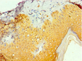 Immunohistochemistry of paraffin-embedded human skin tissue using TIA1 Antibody at dilution of 1: 100Rabbit anti-Human TIA1 Polyclonal Antibody