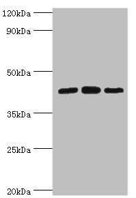 Western blot | All lanes: Nucleolysin TIA-1 isoform p40 antibody at 2μg/ml | Lane 1: Jurkat whole cell lysate | Lane 2: K562 whole cell lysate | Lane 3: Hela whole cell lysate | Secondary | Goat polyclonal to rabbit IgG at 1/10000 dilution | Predicted band size: 43, 42, 25 kDa | Observed band size: 43 kDaRabbit anti-Human TIA1 Polyclonal Antibody