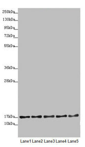 Western blot | All lanes: TIMM17B antibody at 1.75 μg/ml | Lane 1: U251 whole cell lysate | Lane 2: Jurkat whole cell lysate | Lane 3: HepG2 whole cell lysate | Lane 4: HL60 whole cell lysate | Lane 5: A431 whole cell lysate | Secondary | Goat polyclonal to rabbit IgG at 1/10000 dilution | Predicted band size: 19, 24 kDa | Observed band size: 19 kDaRabbit anti-Human TIMM17B Polyclonal Antibody