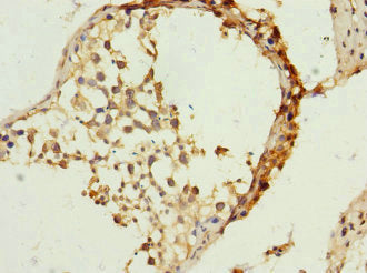 Immunohistochemistry of paraffin-embedded human testis tissue using TIMM23 Antibody at dilution of 1:100Rabbit anti-Human TIMM23 Polyclonal Antibody