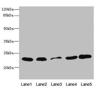 Western blot  | All lanes: TIMM23 antibody at 3.03µg/ml  | Lane 1: Rat heart tissue  | Lane 2: Mouse liver tissue  | Lane 3: A431 whole cell lysate  | Lane 4: MCF-7 whole cell lysate  | Lane 5: Jurkat whole cell lysate  | Secondary  | Goat polyclonal to rabbit IgG at 1/10000 dilution  | Predicted band size: 22 kDa  | Observed band size: 22 kDaRabbit anti-Human TIMM23 Polyclonal Antibody
