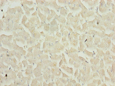Immunohistochemistry of paraffin-embedded human heart tissue using the antibody at dilution of 1:100Rabbit anti-Human TIMP1 Polyclonal Antibody
