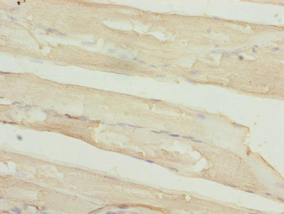 Immunohistochemistry of paraffin-embedded human skeletal muscle tissue using TIMP1 Antibody at dilution of 1:100Rabbit anti-Human TIMP1 Polyclonal Antibody