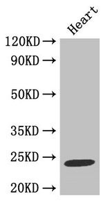 Western Blot  | Positive WB detected in: Mouse heart tissue  | All lanes: TIMP1 antibody at 2µg/ml  | Secondary  | Goat polyclonal to rabbit IgG at 1/50000 dilution  | Predicted band size: 24 kDa  | Observed band size: 24 kDaRabbit anti-Human TIMP1 Polyclonal Antibody