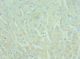 Immunohistochemistry of paraffin-embedded human liver tissue using TIRAP Antibody at dilution of 1:100Rabbit anti-Human TIRAP Polyclonal Antibody