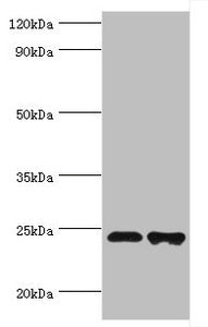 Western blot | All lanes: Toll/interleukin-1 receptor domain-containing adapter protein antibody at 2μg/ml | Lane 1: K562 whole cell lysate | Lane 2: Mouse kidney tissue | Secondary | Goat polyclonal to rabbit IgG at 1/10000 dilution | Predicted band size: 24, 26, 28 kDa | Observed band size: 24 kDaRabbit anti-Human TIRAP Polyclonal Antibody