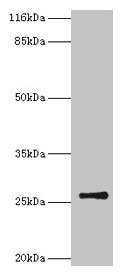 Western blot  | All lanes: TK1 antibody at 2µg/ml + CEM whole cell lysate  | Secondary  | Goat polyclonal to rabbit IgG at 1/10000 dilution  | Predicted band size: 26 kDa  | Observed band size: 26 kDaRabbit anti-Human TK1 Polyclonal Antibody