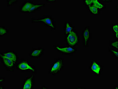 Immunofluorescent analysis of Hela cells using TLL1 Antibody at dilution of 1:100 and Alexa Fluor 488-congugated AffiniPure Goat Anti-Rabbit IgG(H+L)Rabbit anti-Human TLL1 Polyclonal Antibody