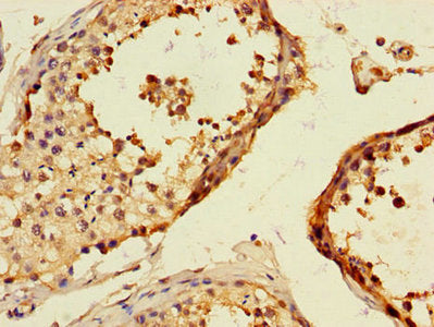 Immunohistochemistry of paraffin-embedded human testis tissue using TLL1 Antibody at dilution of 1:100Rabbit anti-Human TLL1 Polyclonal Antibody
