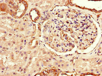 Immunohistochemistry of paraffin-embedded human kidney tissue using TLR3 Antibody at dilution of 1:100Rabbit anti-Human TLR3 Polyclonal Antibody