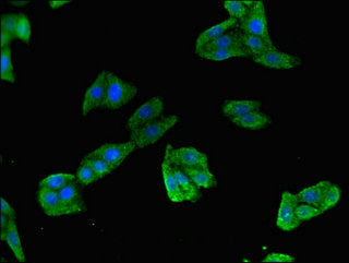 Immunofluorescent analysis of HepG2 cells using TLR5 Antibody at dilution of 1:100 and Alexa Fluor 488-congugated AffiniPure Goat Anti-Rabbit IgG(H+L)Rabbit anti-Human TLR5 Polyclonal Antibody