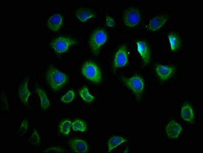 Immunofluorescence staining of A549 cells with the antibody at 1:166, counter-stained with DAPI. The cells were fixed in 4% formaldehyde, permeabilized using 0.2% Triton X-100 and blocked in 10% normal Goat Serum. The cells were then incubated with the antibody overnight at 4°C. The secondary antibody was Alexa Fluor 488-congugated AffiniPure Goat Anti-Rabbit IgG(H+L).Rabbit anti-Human TLR6 Polyclonal Antibody