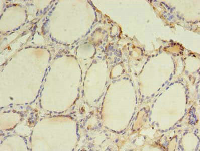 Immunohistochemistry of paraffin-embedded human thyroid tissue using TLR6 Antibody at dilution of 1:100Rabbit anti-Human TLR6 Polyclonal Antibody
