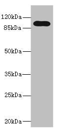 Western blot  | All lanes: TLR6 antibody at 5µg/ml + Jurkat whole cell lysate  | Secondary  | Goat polyclonal to rabbit IgG at 1/10000 dilution  | Predicted band size: 92, 56 kDa  | Observed band size: 92 kDaRabbit anti-Human TLR6 Polyclonal Antibody