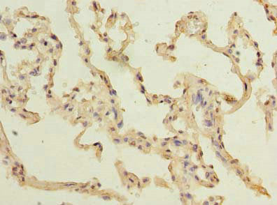 Immunohistochemistry of paraffin-embedded human lung tissue using the antibody at dilution of 1:100Rabbit anti-Human TM4SF1 Polyclonal Antibody
