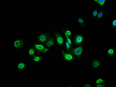 Immunofluorescence staining of HepG2 cells with TM6SF2 Antibody at 1:133, counter-stained with DAPI. The cells were fixed in 4% formaldehyde, permeabilized using 0.2% Triton X-100 and blocked in 10% normal Goat Serum. The cells were then incubated with the antibody overnight at 4°C. The secondary antibody was Alexa Fluor 488-congugated AffiniPure Goat Anti-Rabbit IgG(H+L).Rabbit anti-Human TM6SF2 Polyclonal Antibody