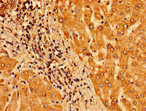 Immunohistochemistry of paraffin-embedded human liver tissue using the antibody at dilution of 1:100Rabbit anti-Human TM6SF2 Polyclonal Antibody
