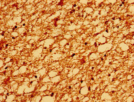 Immunohistochemistry of paraffin-embedded human brain tissue using TM6SF2 Antibody at dilution of 1:100Rabbit anti-Human TM6SF2 Polyclonal Antibody