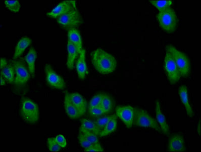 Immunofluorescence staining of HepG2 cells with DCSTAMP Antibody at 1:66, counter-stained with DAPI. The cells were fixed in 4% formaldehyde, permeabilized using 0.2% Triton X-100 and blocked in 10% normal Goat Serum. The cells were then incubated with the antibody overnight at 4°C. The secondary antibody was Alexa Fluor 488-congugated AffiniPure Goat Anti-Rabbit IgG(H+L).Rabbit anti-Human DCSTAMP Polyclonal Antibody