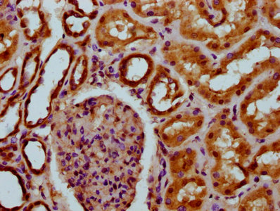 IHC image of the antibody diluted at 1:200 and staining in paraffin-embedded human kidney tissue performed on a Leica BondTM system. After dewaxing and hydration, antigen retrieval was mediated by high pressure in a citrate buffer (pH 6.0). Section was blocked with 10% normal goat serum 30min at RT. Then primary antibody (1% BSA) was incubated at 4°C overnight. The primary is detected by a biotinylated secondary antibody and visualized using an HRP conjugated SP system.Rabbit anti-Human DCSTAMP Polyclonal Antibody