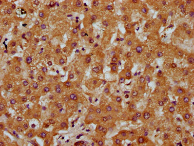 IHC image of DCSTAMP Antibody diluted at 1:200 and staining in paraffin-embedded human liver tissue performed on a Leica BondTM system. After dewaxing and hydration, antigen retrieval was mediated by high pressure in a citrate buffer (pH 6.0). Section was blocked with 10% normal goat serum 30min at RT. Then primary antibody (1% BSA) was incubated at 4°C overnight. The primary is detected by a biotinylated secondary antibody and visualized using an HRP conjugated SP system.Rabbit anti-Human DCSTAMP Polyclonal Antibody