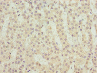 Immunohistochemistry of paraffin-embedded human adrenal gland tissue using TM9SF1 Antibody at dilution of 1:100Rabbit anti-Human TM9SF1 Polyclonal Antibody