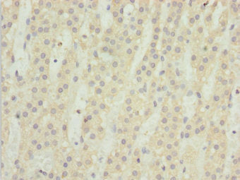 Immunohistochemistry of paraffin-embedded human adrenal gland tissue using TM9SF1 Antibody at dilution of 1:100Rabbit anti-Human TM9SF1 Polyclonal Antibody