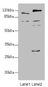 Western blot | All lanes: TM9SF1 antibody at 2.18μg/ml | Lane 1: Mouse liver tissue | Lane 2: Mouse kidney tissue | Secondary | Goat polyclonal to rabbit IgG at 1/10000 dilution | Predicted band size: 69, 56 kDa | Observed band size: 69, 110, 59, 28 kDaRabbit anti-Human TM9SF1 Polyclonal Antibody