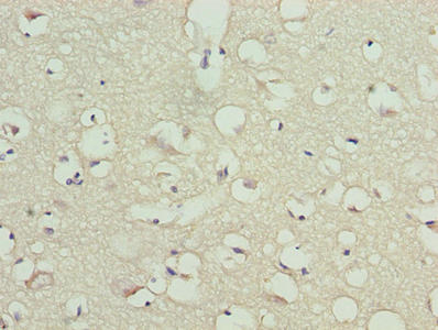 Immunohistochemistry of paraffin-embedded human brain tissue using TMCC1 Antibody at dilution of 1:100Rabbit anti-Human TMCC1 Polyclonal Antibody