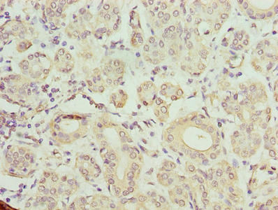 Immunohistochemistry of paraffin-embedded human salivary gland tissue using TMCC1 Antibody at dilution of 1:100Rabbit anti-Human TMCC1 Polyclonal Antibody