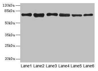 Western blot  | All lanes: TMCC1 antibody at 1µg/ml  | Lane 1: MCF-7 whole cell lysate  | Lane 2: Mouse liver tissue  | Lane 3: Mouse kidney tissue  | Lane 4: HL60 whole cell lysate  | Lane 5: K562 whole cell lysate  | Lane 6: U937 whole cell lysate  | Secondary  | Goat polyclonal to rabbit IgG at 1/10000 dilution  | Predicted band size: 73, 54 kDa  | Observed band size: 73 kDaRabbit anti-Human TMCC1 Polyclonal Antibody