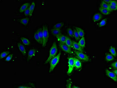 Immunofluorescent analysis of HepG2 cells using RPLP1 Antibody at dilution of 1:100 and Alexa Fluor 488-congugated AffiniPure Goat Anti-Rabbit IgG(H+L)Rabbit anti-Human RPLP1 Polyclonal Antibody