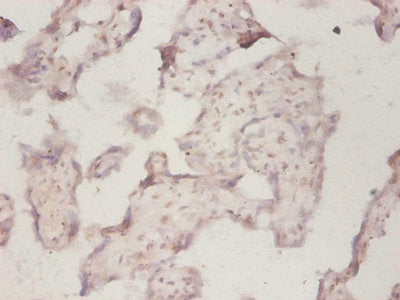 Immunohistochemistry of paraffin-embedded human placenta tissue using RPLP1 Antibody at dilution of 1:50Rabbit anti-Human RPLP1 Polyclonal Antibody
