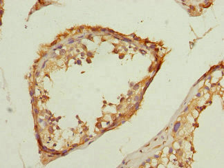 Immunohistochemistry of paraffin-embedded human testis tissue using TMED10 Antibody at dilution of 1:100Rabbit anti-Human TMED10 Polyclonal Antibody