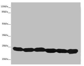 Western blot  | All lanes: TMED10 antibody at 4.88µg/ml  | Lane 1: Hela whole cell lysate  | Lane 2: Mouse liver tissue  | Lane 3: Mouse lung tissue  | Lane 4: 293T whole cell lysate  | Lane 5: NIH/3T3 whole cell lysate  | Lane 6: U87 whole cell lysate  | Secondary  | Goat polyclonal to rabbit IgG at 1/10000 dilution  | Predicted band size: 25 kDa  | Observed band size: 25 kDaRabbit anti-Human TMED10 Polyclonal Antibody