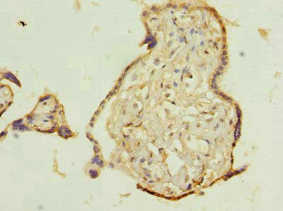 Immunohistochemistry of paraffin-embedded human placenta tissue using the antibody at dilution of 1:100Rabbit anti-Human TMEM115 Polyclonal Antibody