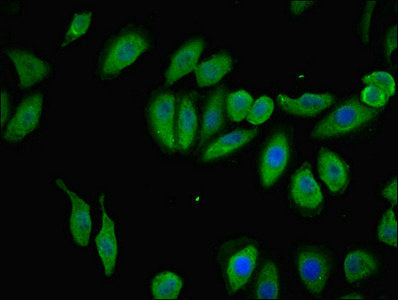 Immunofluorescent analysis of A549 cells using TMEM120B Antibody at dilution of 1:100 and Alexa Fluor 488-congugated AffiniPure Goat Anti-Rabbit IgG(H+L)Rabbit anti-Human TMEM120B Polyclonal Antibody