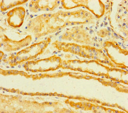 Immunohistochemistry of paraffin-embedded human kidney tissue using the antibody at dilution of 1:100Rabbit anti-Human TMEM120B Polyclonal Antibody