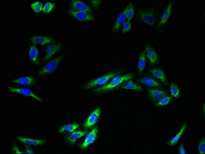 Immunofluorescent analysis of HepG2 cells using TMEM140 Antibody at dilution of 1:100 and Alexa Fluor 488-congugated AffiniPure Goat Anti-Rabbit IgG(H+L)Rabbit anti-Human TMEM140 Polyclonal Antibody