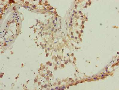 Immunohistochemistry of paraffin-embedded human testis tissue using the antibody at dilution of 1:100Rabbit anti-Human TMEM140 Polyclonal Antibody