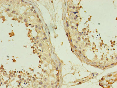 Immunohistochemistry of paraffin-embedded human testis tissue using TMEM141 Antibody at dilution of 1:100Rabbit anti-Human TMEM141 Polyclonal Antibody