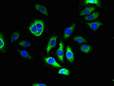 Immunofluorescent analysis of A549 cells using TMEM143 Antibody at dilution of 1:100 and Alexa Fluor 488-congugated AffiniPure Goat Anti-Rabbit IgG(H+L)Rabbit anti-Human TMEM143 Polyclonal Antibody